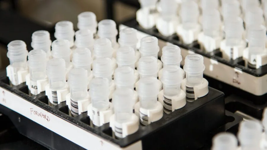 Increasing Capacity: Blood Plasma Processing