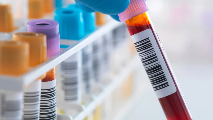 Capacity Increase: Protein Purification